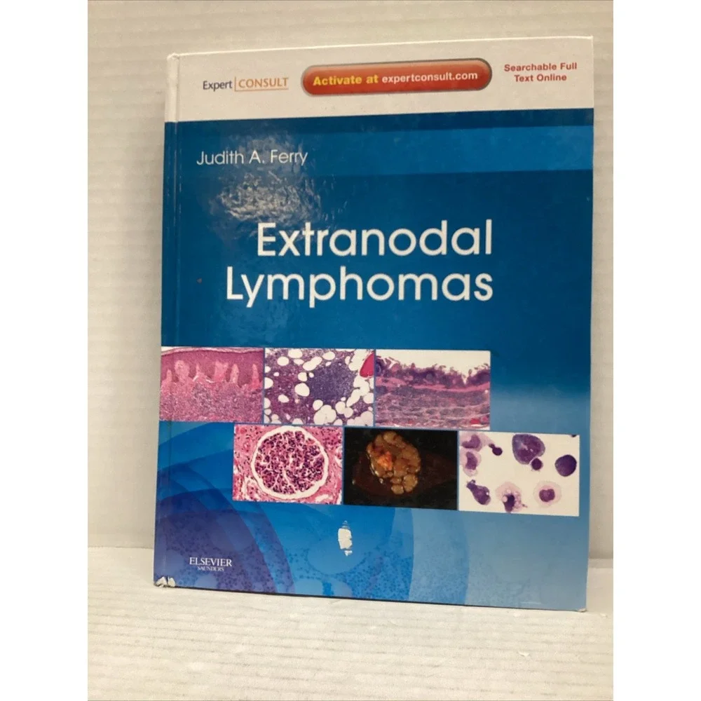 Extranodal Lymphomas : Expert Consult - Online and Print by Judith A. Ferry...